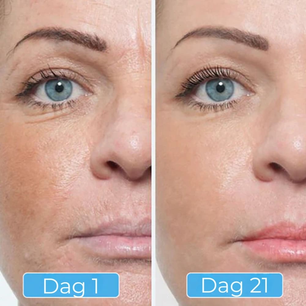 Glowskin Pro - Masque LED Soin Visage & Cou